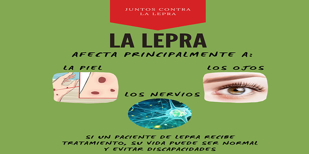 En Oaxaca se registraron cinco casos de lepra